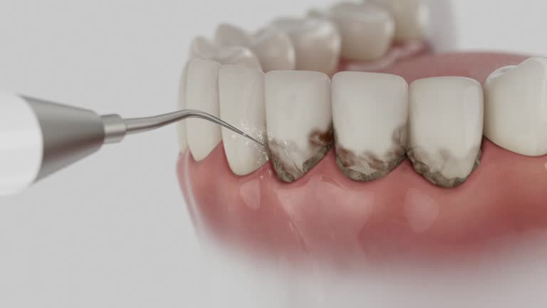 Trusted Tooth Extraction service in University Heights, OH - Dentist Open Now